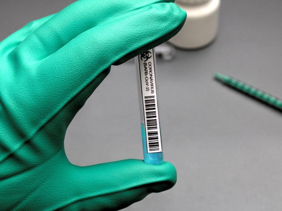 Eine behandschuhte Hand hält einen Corona Test.